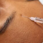 Anti-Aging Treatments - Injecting Person's Forehead
